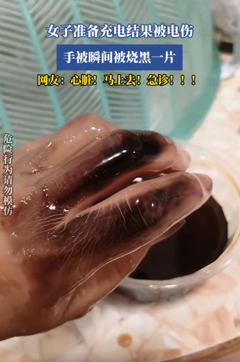 心够大的！广东，一女子手不小心被电了。事后手背上留了一块黑印子，看着挺吓人，但她