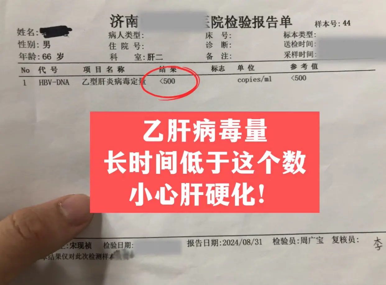 济南本地的乙肝患者今天来复查，病毒量从小于500到20000多，通过问...