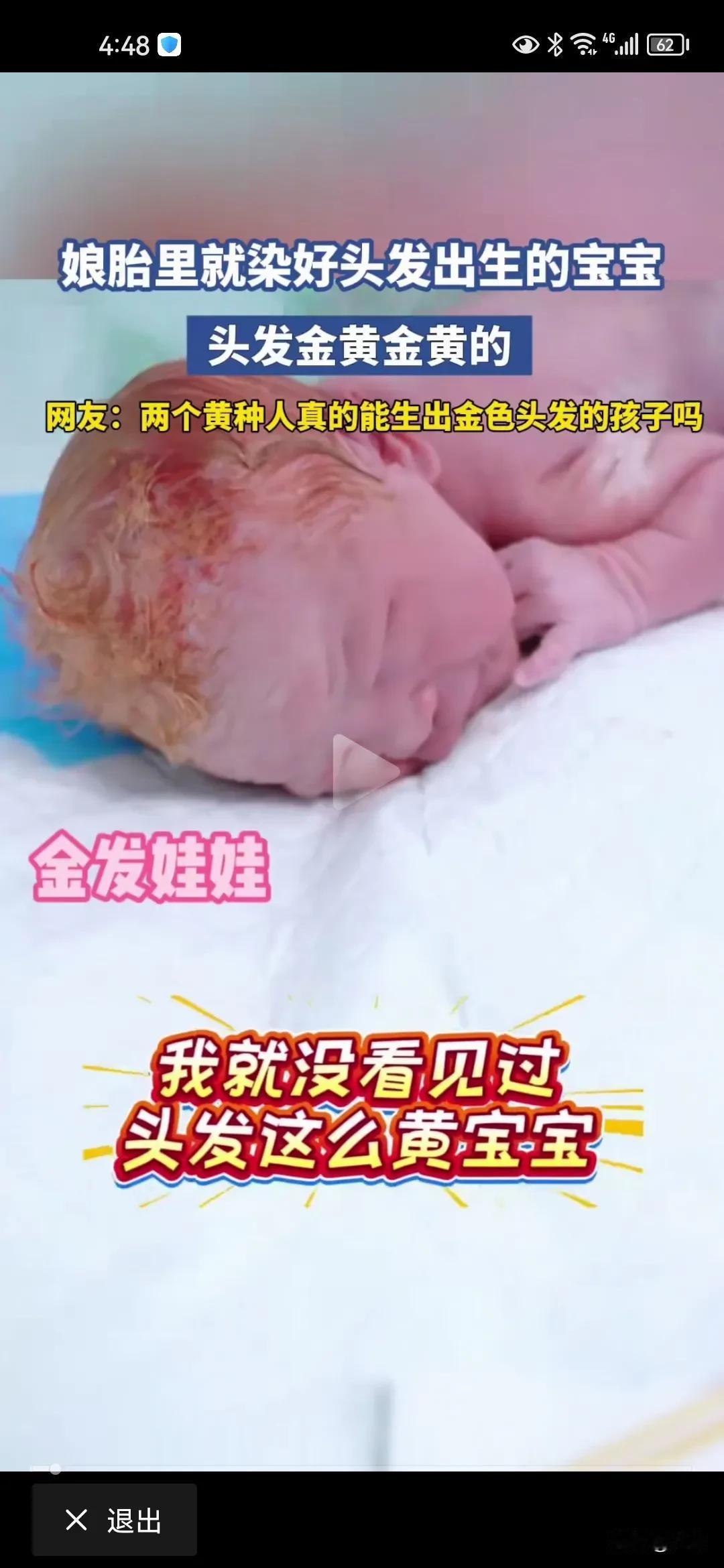 黑加绿等于黄，今日有一头黑发的年轻妈妈生了个满头金发的宝宝，爸爸是天生绿色头发，