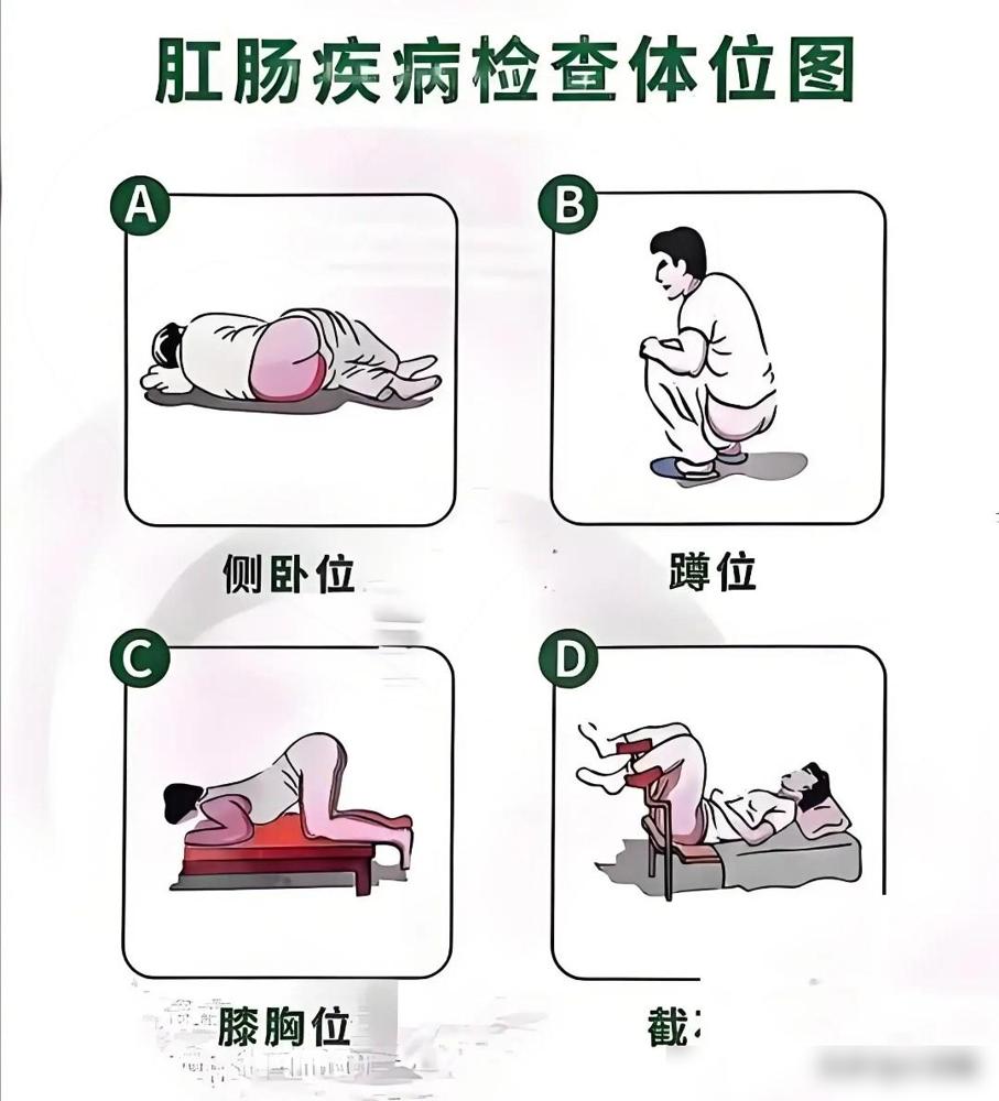 我闺蜜是医生，今天她告诉我一个惊人的秘密：之前我总觉得去肛肠科看病是顶社死的