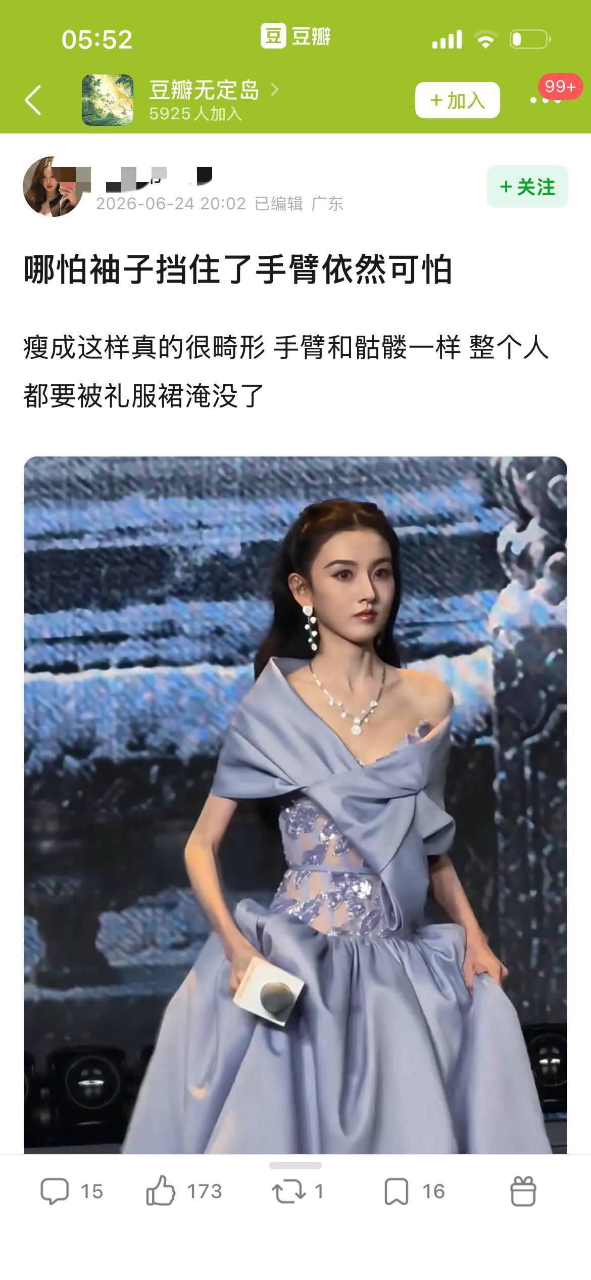 瘦到吓人？宋祖儿红毯状态引争议，内娱白瘦幼审美已经内卷到离谱地步？红毯亮相的