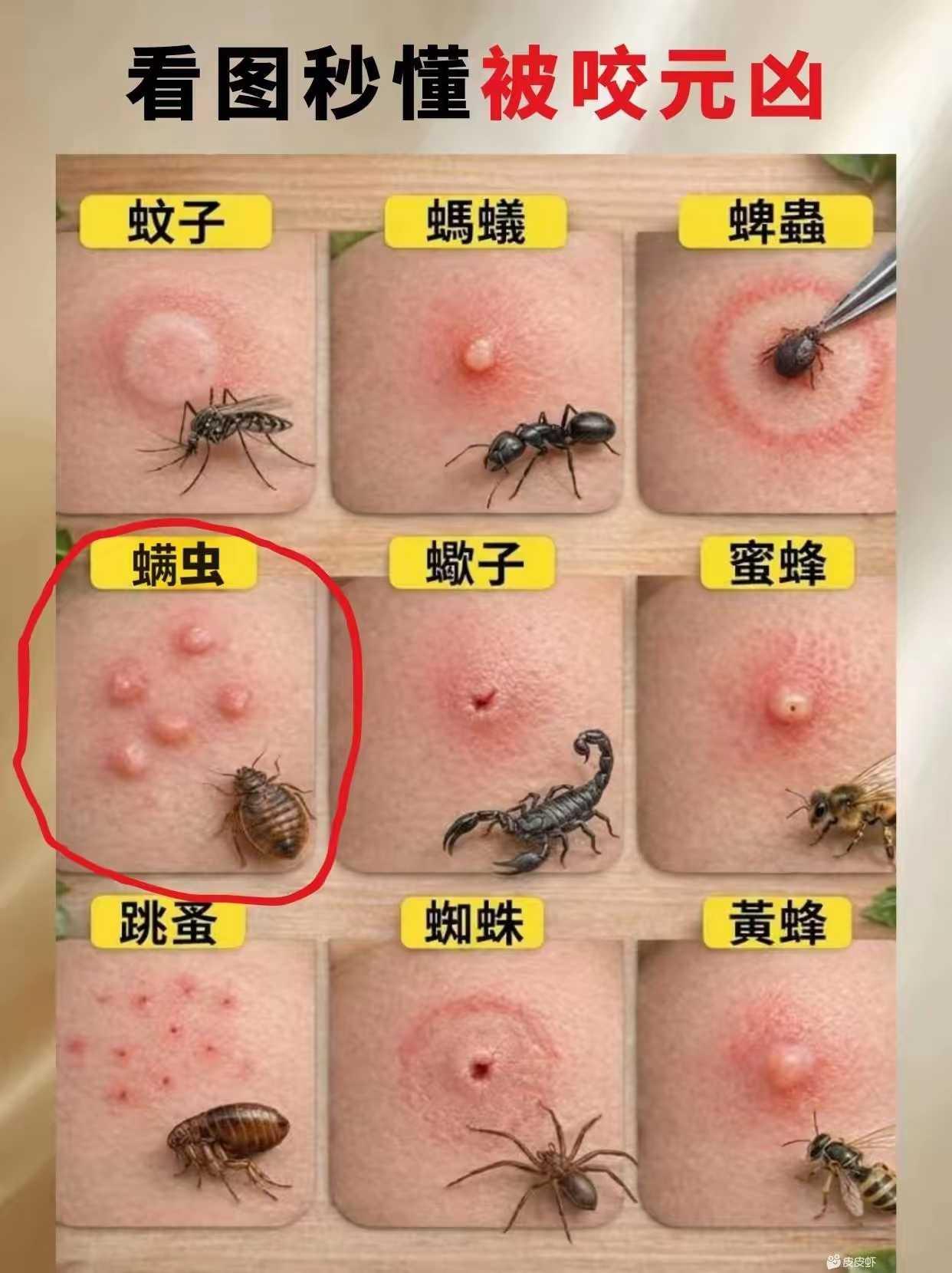夏天虫子多，是时候亮出这张图了