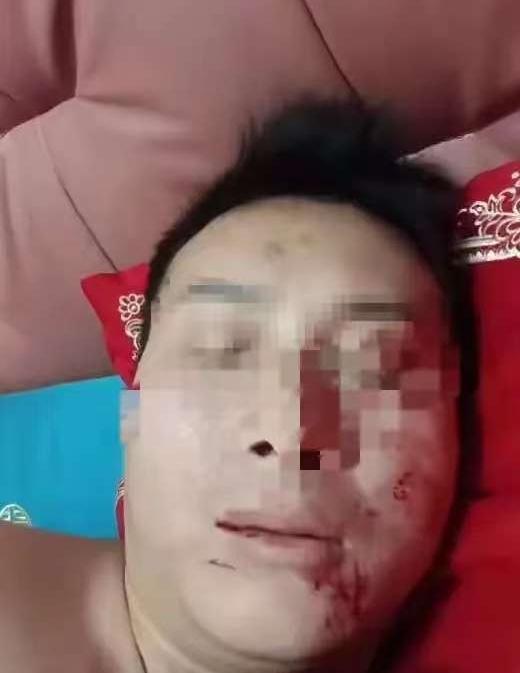 笑不活了，一男子在新婚夜，想和妻子过夫妻生活，却被妻子抓了个大花脸，吕先生心想这