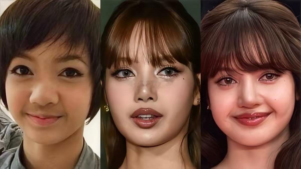 Lisa的三次整容
