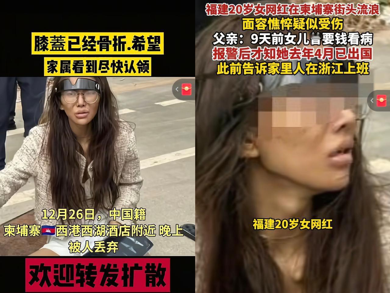吴某太亏了！吴某不仅白白被玩了，还落下一身伤病，好好一个大美女，本可以靠颜值和努