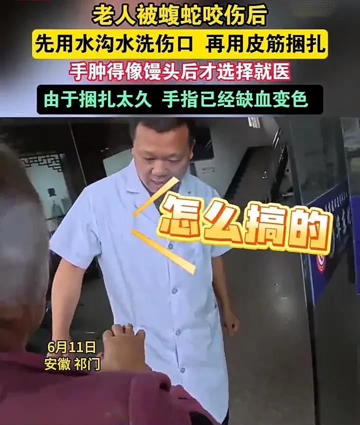 有些事情不能心存侥幸！6月11日，安徽黄山祁门一位老人不慎被蝮蛇咬伤，但她没有立