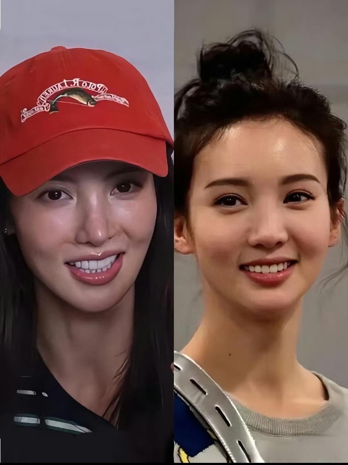 真搞不懂那些女明星，明明已经非常美丽了，为什么还要花钱去整容？受苦不说，