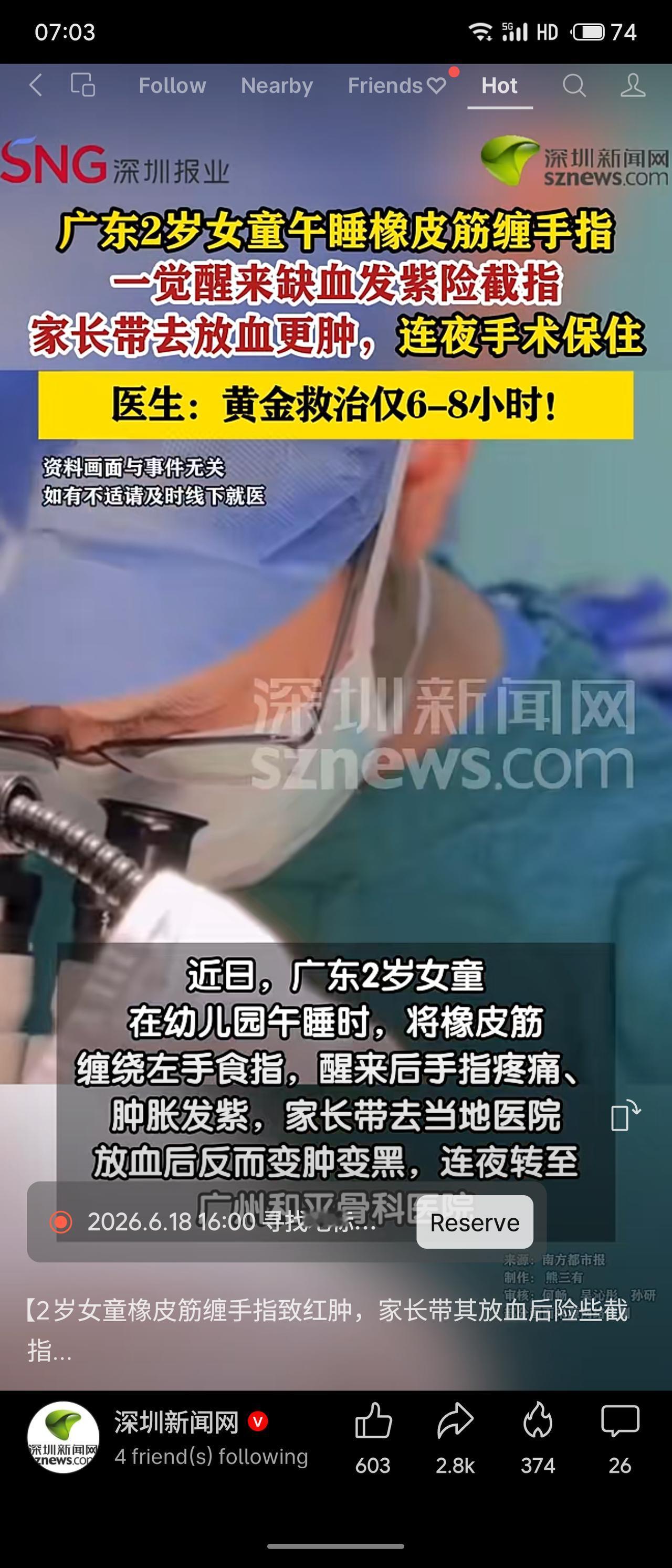 广东2岁女童在幼儿园午睡时，橡皮筋缠绕左手食指致缺血发紫。家长带其至当地医院“放