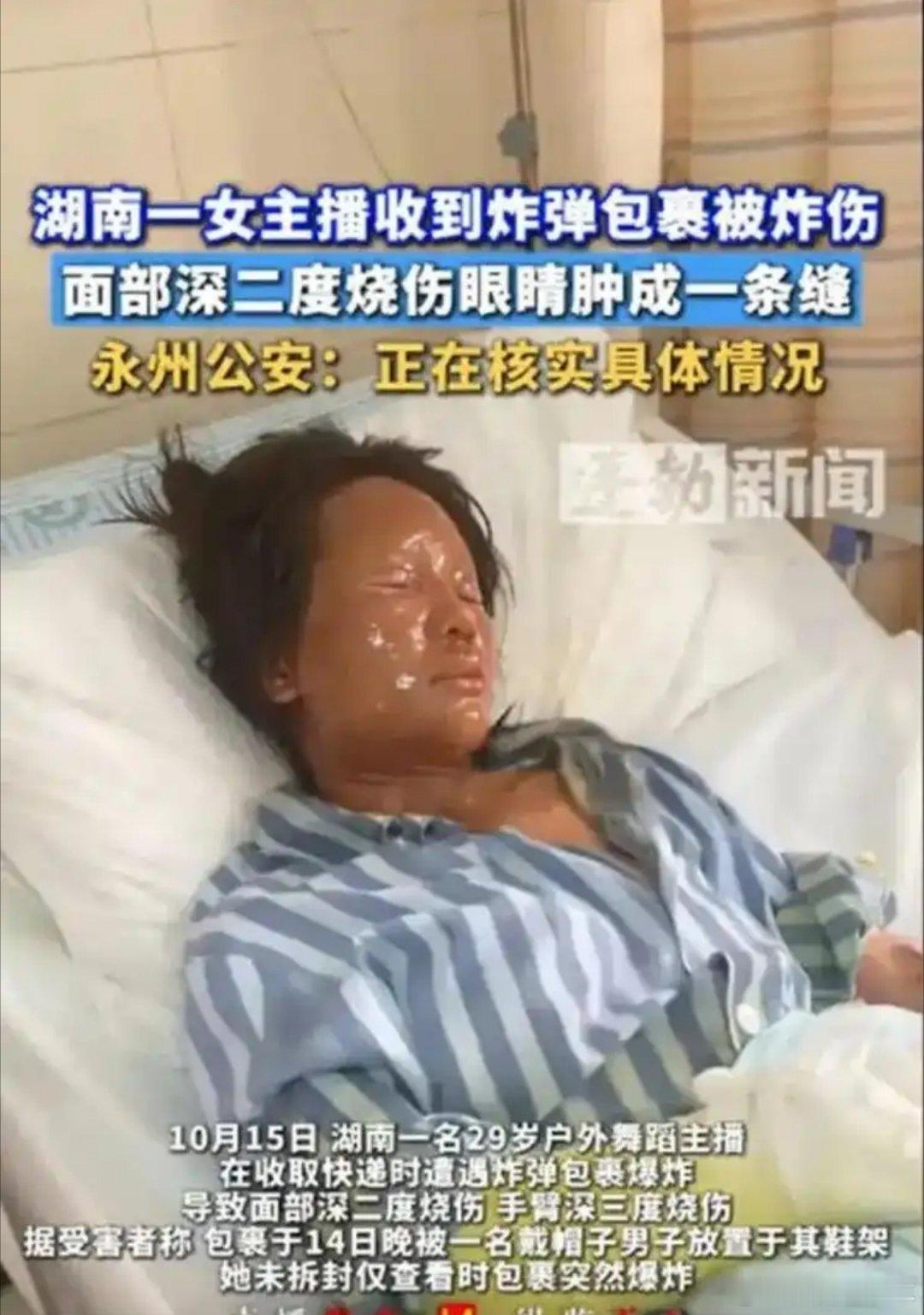 男子因3000元赔偿报复炸伤女主播这个事情给很多主播提了个醒：有些“感情”不能