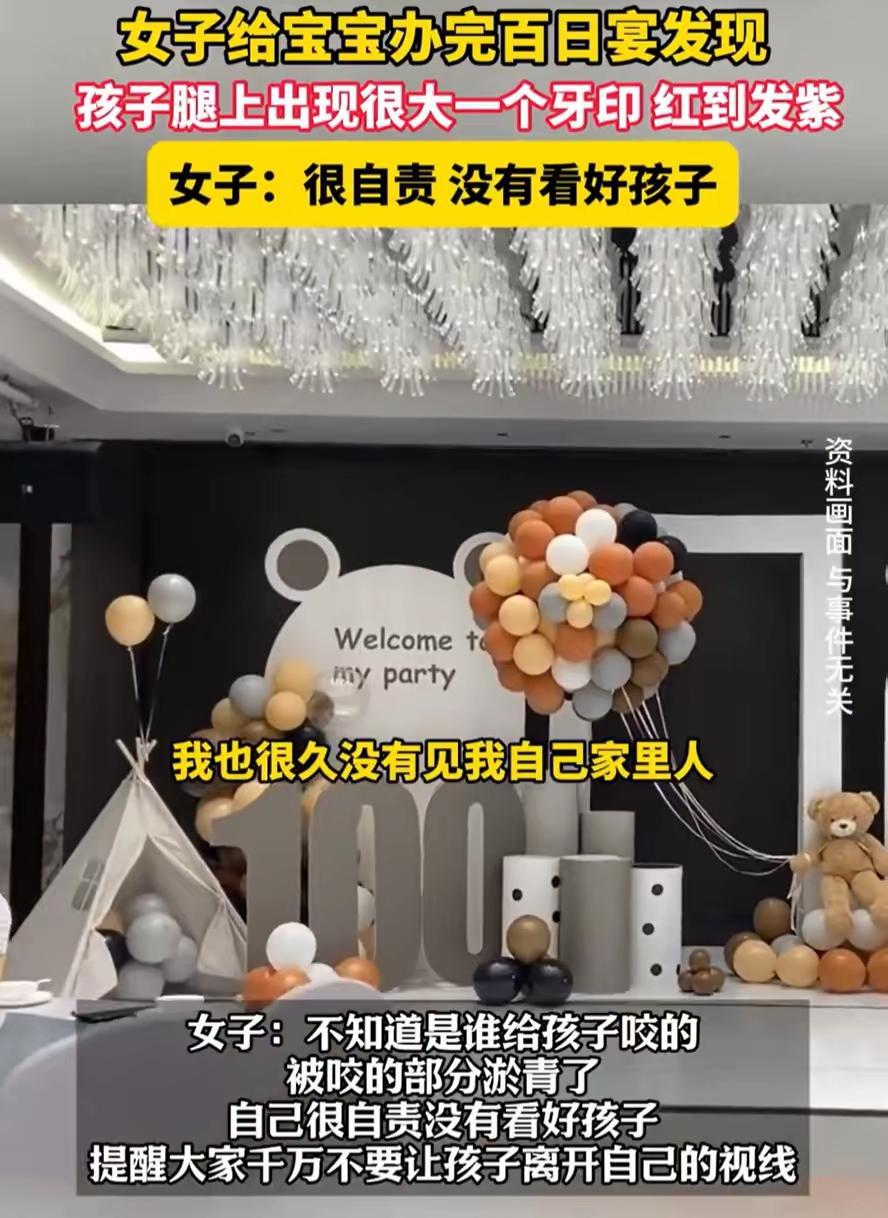 甘肃，一位妈妈给宝宝办百日宴，可晚上宴席结束后，她却发现宝宝的腿上竟然多出来一道