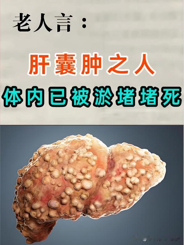 肝囊肿，多是痰瘀在作怪！一剂古方，化痰瘀、消囊肿肝囊肿，看似只是肝脏上长了个“