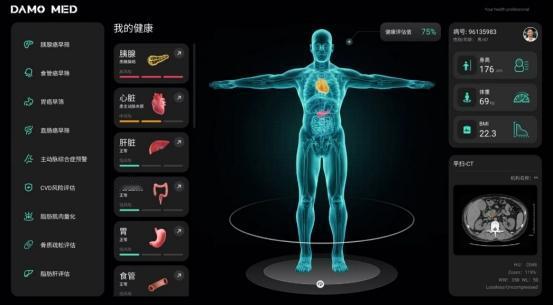 如果不是上海进博会传来消息，国内很多人或许还蒙在鼓里！中国AI发展都走到这一步了