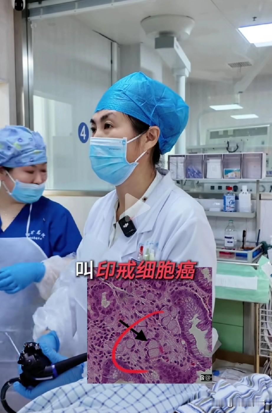 我是胃腺癌和部分印戒细胞癌，双癌患者，印戒细胞癌原来知道很难治愈，现在才知道是如