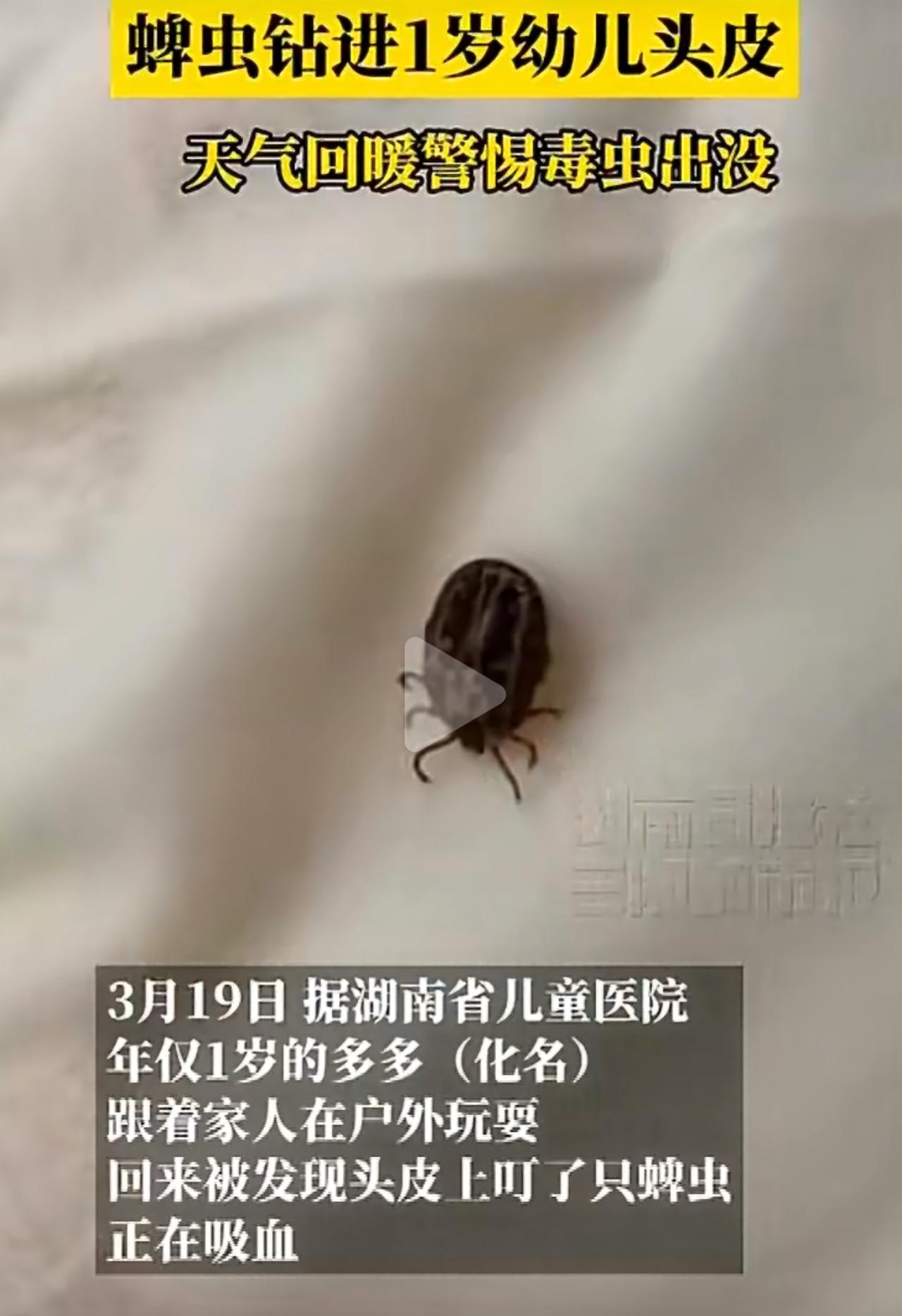 家长晚上哄孩子睡觉，摸到头顶有个像小黑痣的东西，一碰孩子就哭得特别厉害。送到医院