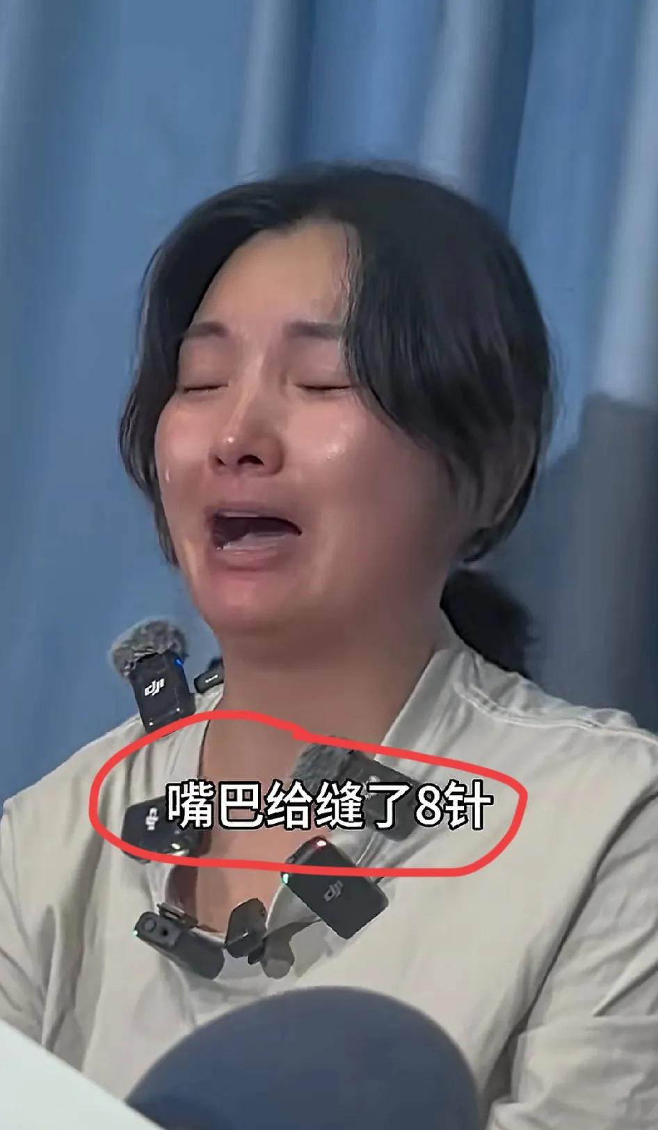 舌头被扎、嘴巴缝针每天吞20片泻药脚还被刀划开，这些本该出现在恐怖片里的情节