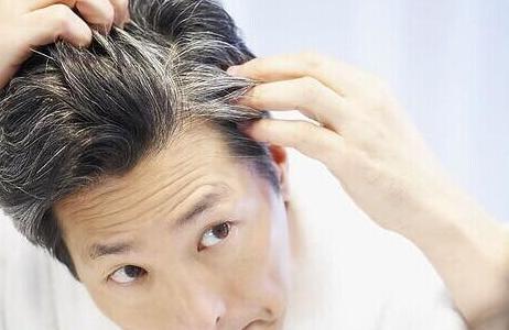 白发不要频繁使用染发剂, 食补更健康, 常吃这些白发慢慢黑起来