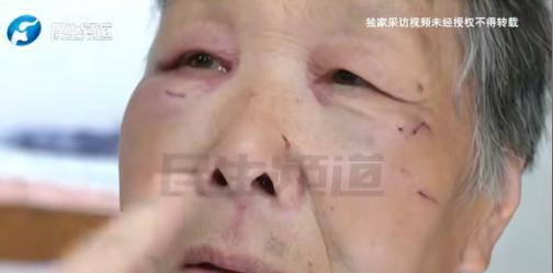 5月2日，河南洛阳，婆婆在厨房刷牙，儿媳让她去卫生间刷，两人发生矛盾继而大打出手