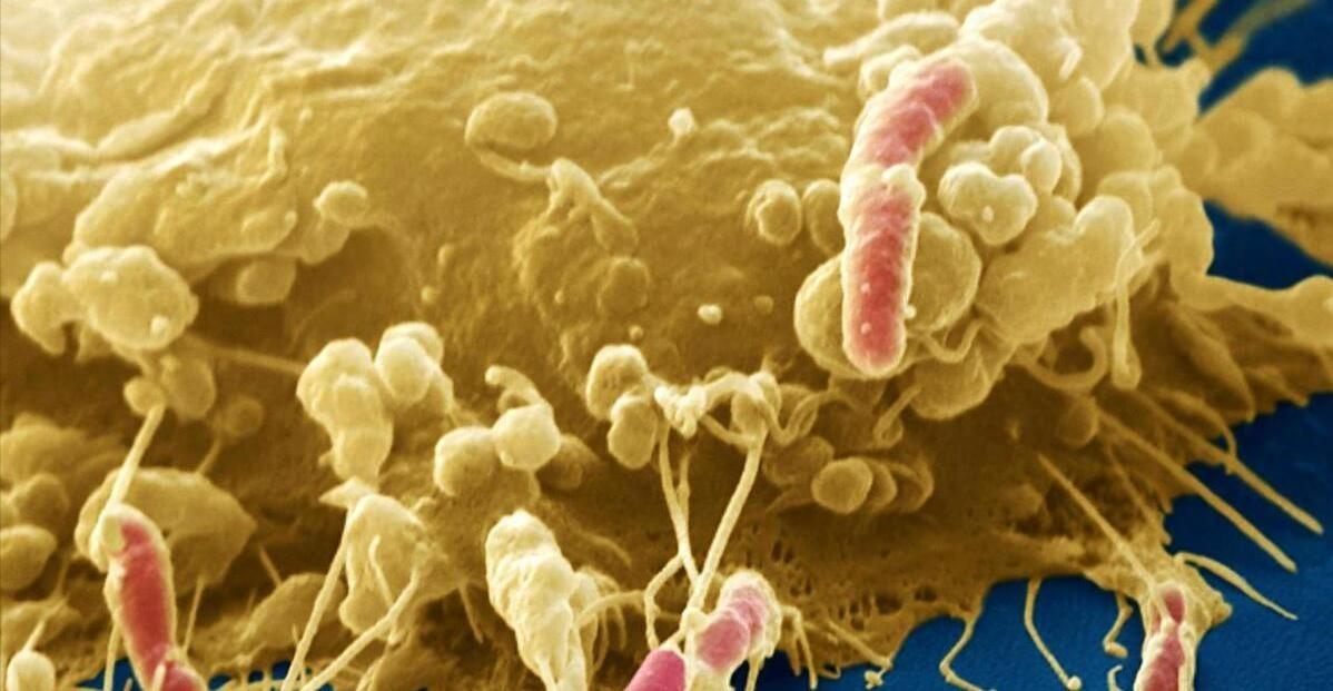 米饭二次加热会"致癌"？再三提醒：这4种食物，最好别二次加热米饭二次加热