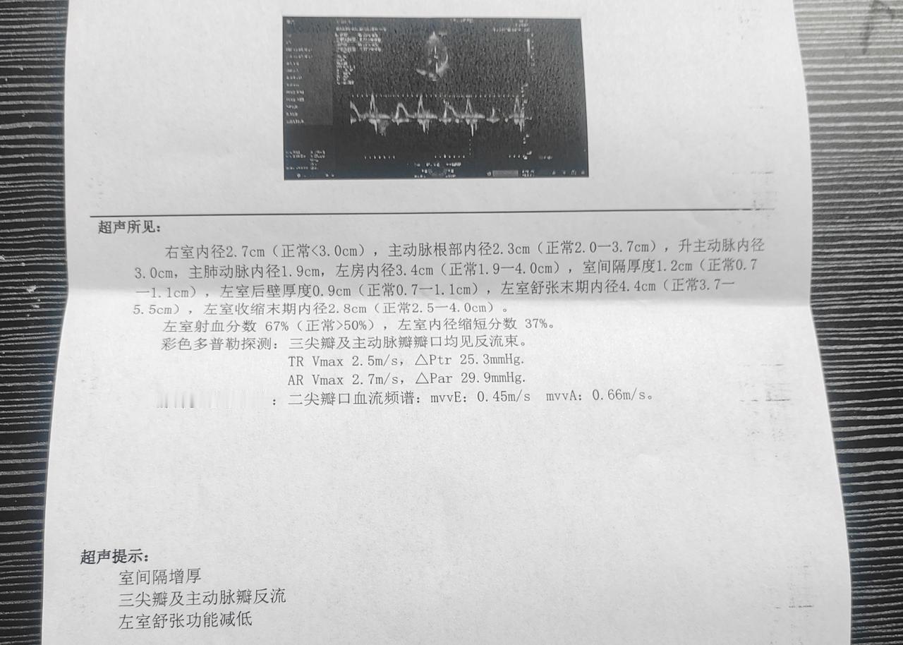 四月二十三日，我第一次检查了一下心脏。没有感到任何不适，就是想检查一下心脏的健