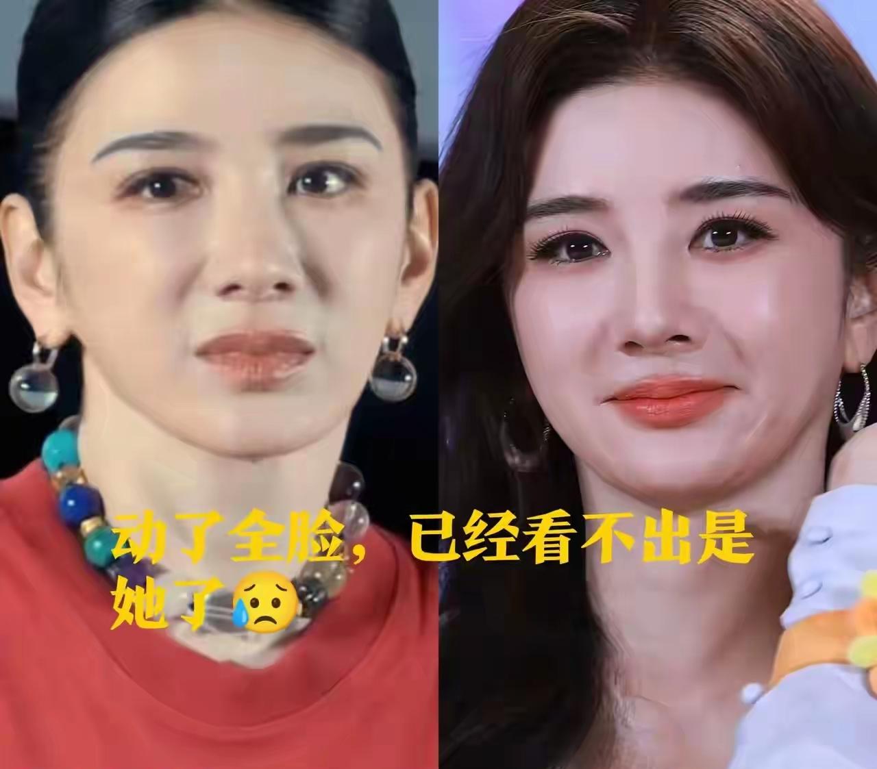 女星真的不能整容，因为本来有辨识度的脸，马上成了流水线网红模板。原本眉眼自带风