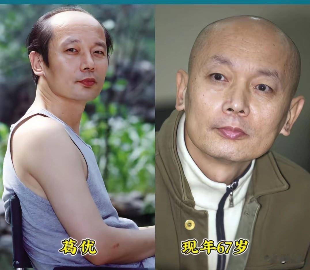 原来光头才是他们的“颜值放大器”✨从青涩少年到光头大叔，这些男演员用岁月证