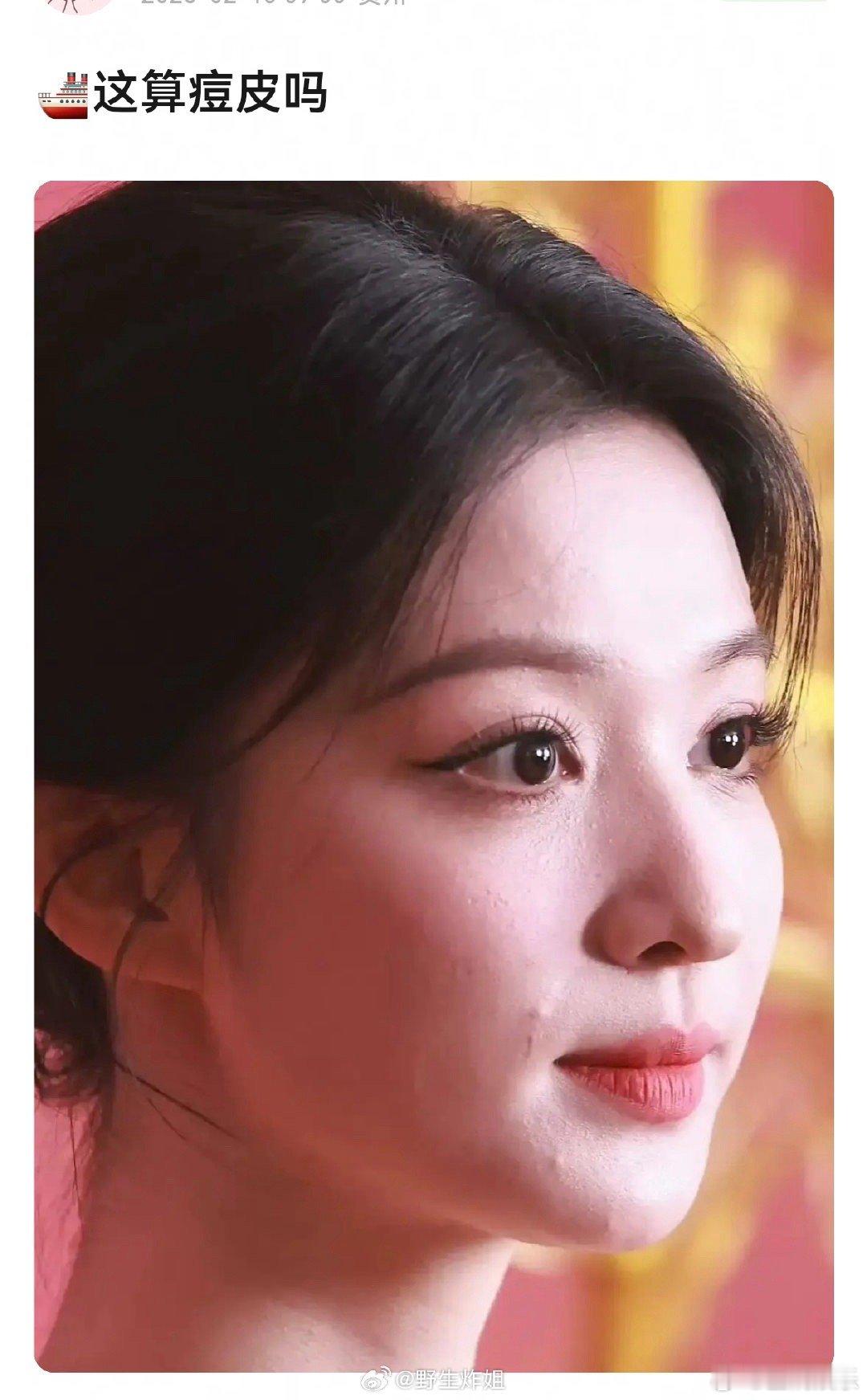 王楚然皮肤状态如何