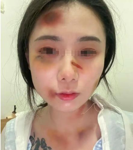 “如不严惩，天理难容！”近日，吉林一男子醉酒后拿起锄头暴打妻子，妻子担心怕被打死