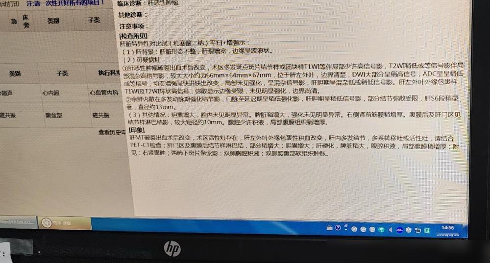 我弟弟得了肝癌，医生说是中晚期，因为突然在家晕倒，120急救真的太懂这种天突