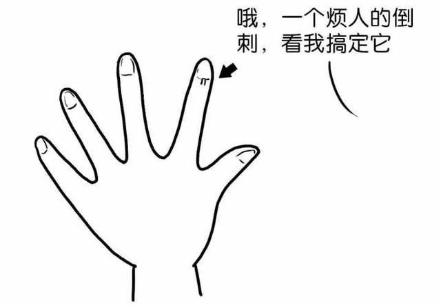 手的指甲周围为什么会长倒刺? 该怎么处理它呢?