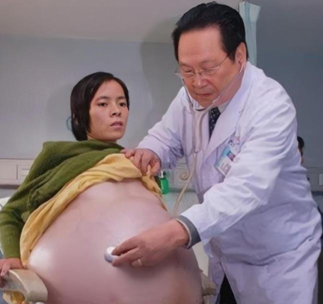 2007年，怀胎12个月的女子，在丈夫的陪同下，挺着巨肚，来到了广州医院检查，没