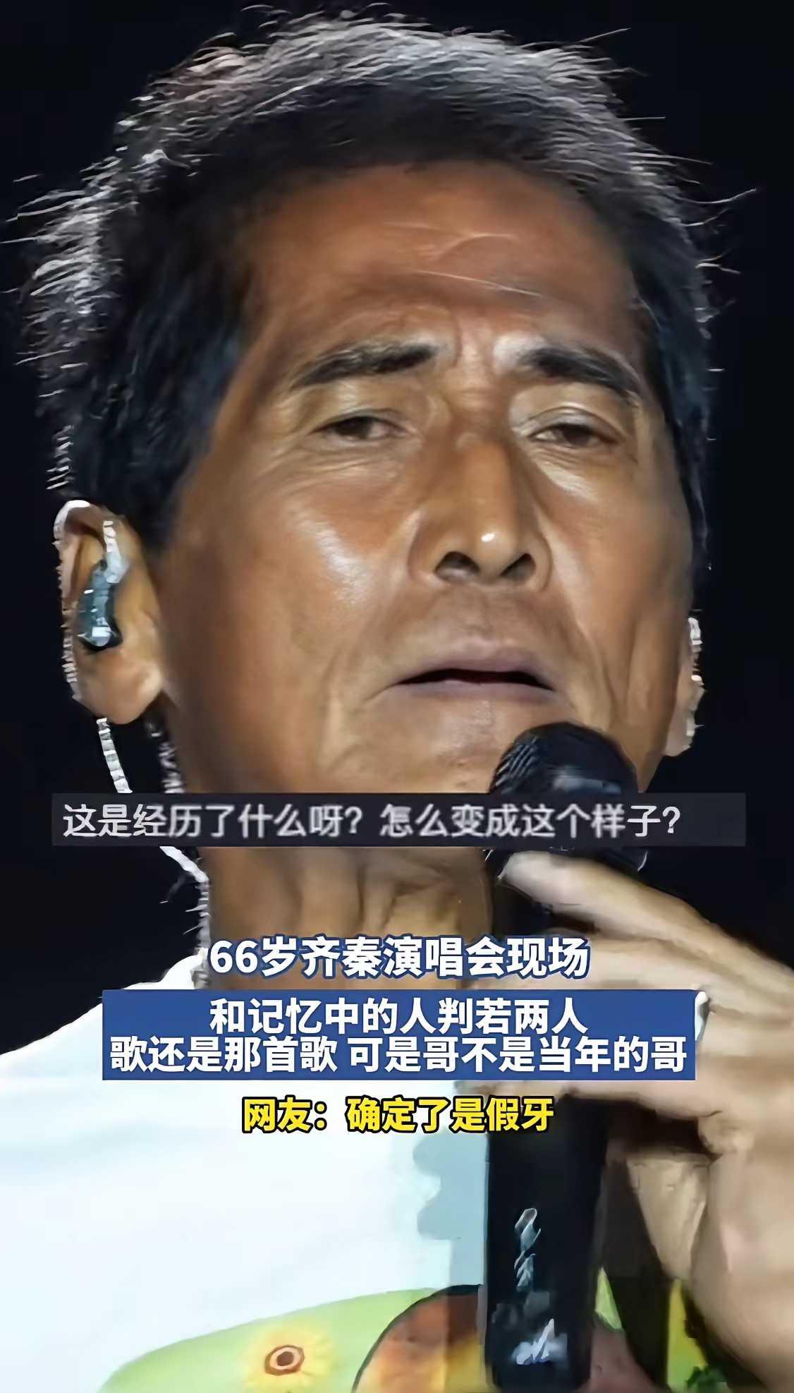 66岁的齐秦出来开演唱会，假牙都上岗了，就这么缺钱吗？