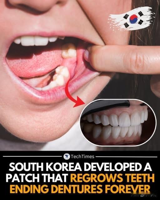首尔国立大学的科学家研发出一种革命性的微针贴片，能够让成年人牙齿自然再生——这项