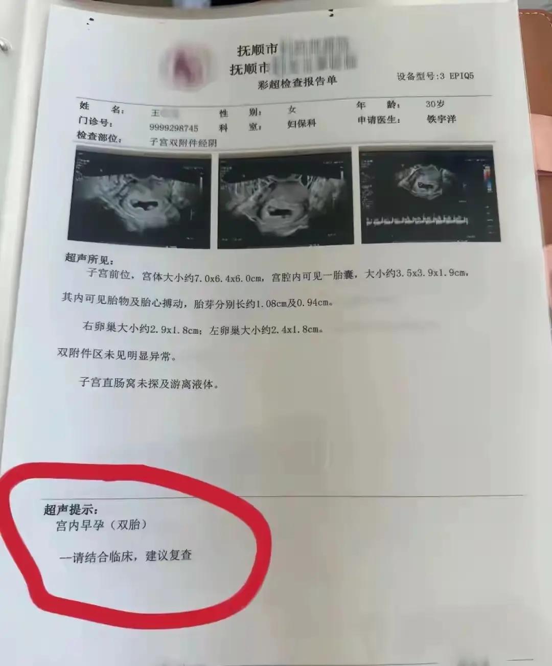 辽宁抚顺的王女士，今年30岁，今年自然怀孕，去年9月份怀上的孕，目前怀孕16周。