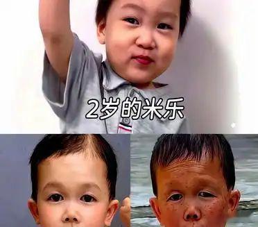 一件两三岁小孩的衣服，连着穿了三年，居然还能严丝合缝。你告诉我，这是发育迟缓，还