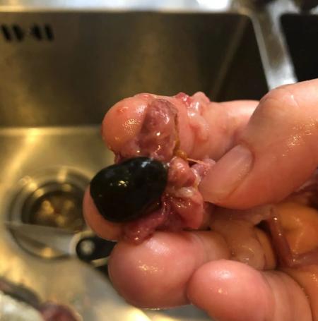 “悲剧还是发生了！”近日，广东深圳，一女子上火后，听信鱼胆有降火的功效，就生吞了