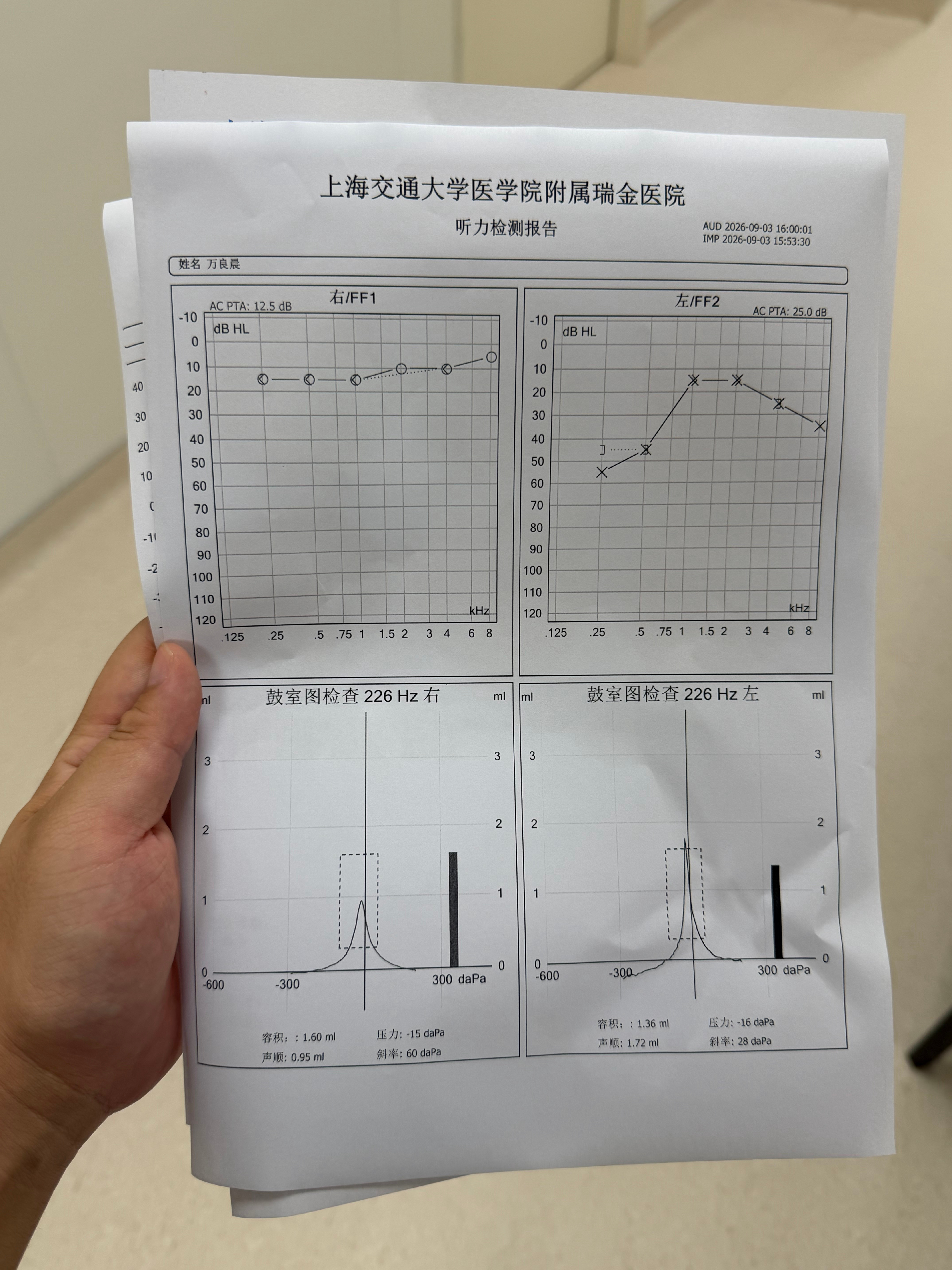 一觉起来感觉左耳朵听不见下午赶紧来医院检查一下医生诊断：特发性突聋[裂开][裂开