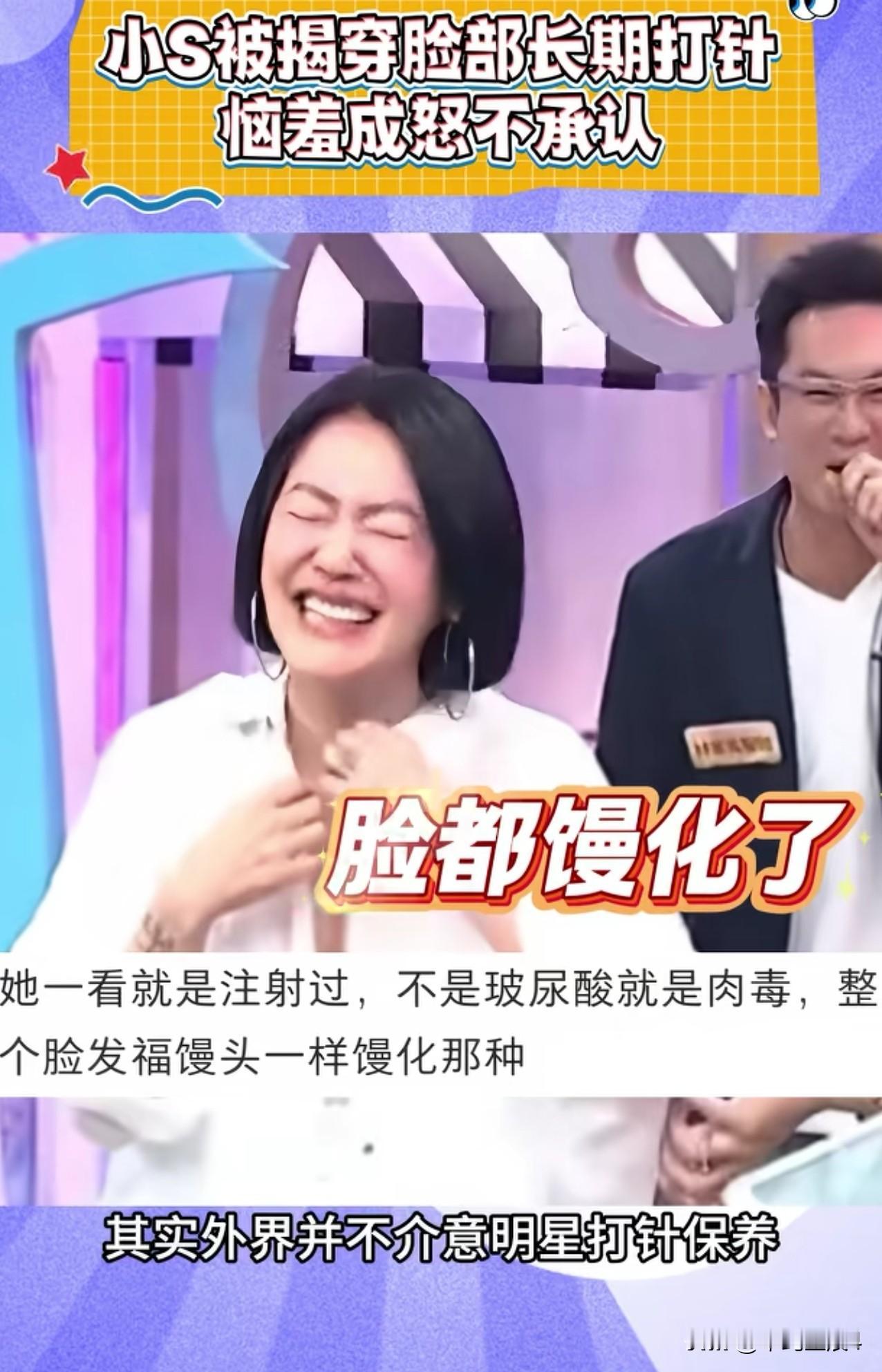 小S糗大了，打玻尿酸被发现了，嘉宾当场揭穿小S脸部打过玻尿酸，不只是以前，一句应