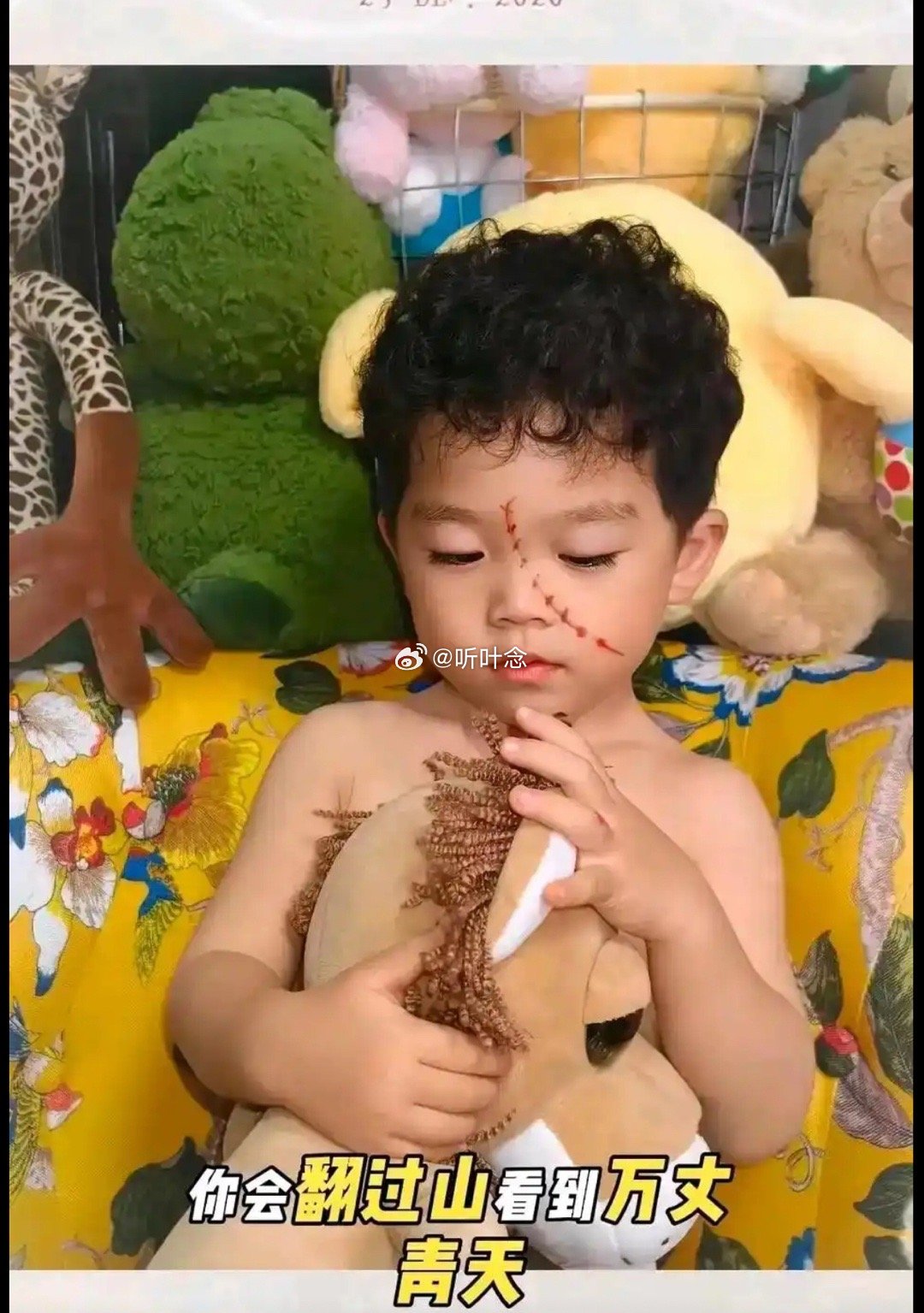 好好的孩子被整成了刀疤脸，意义何在？本来只是个胎记