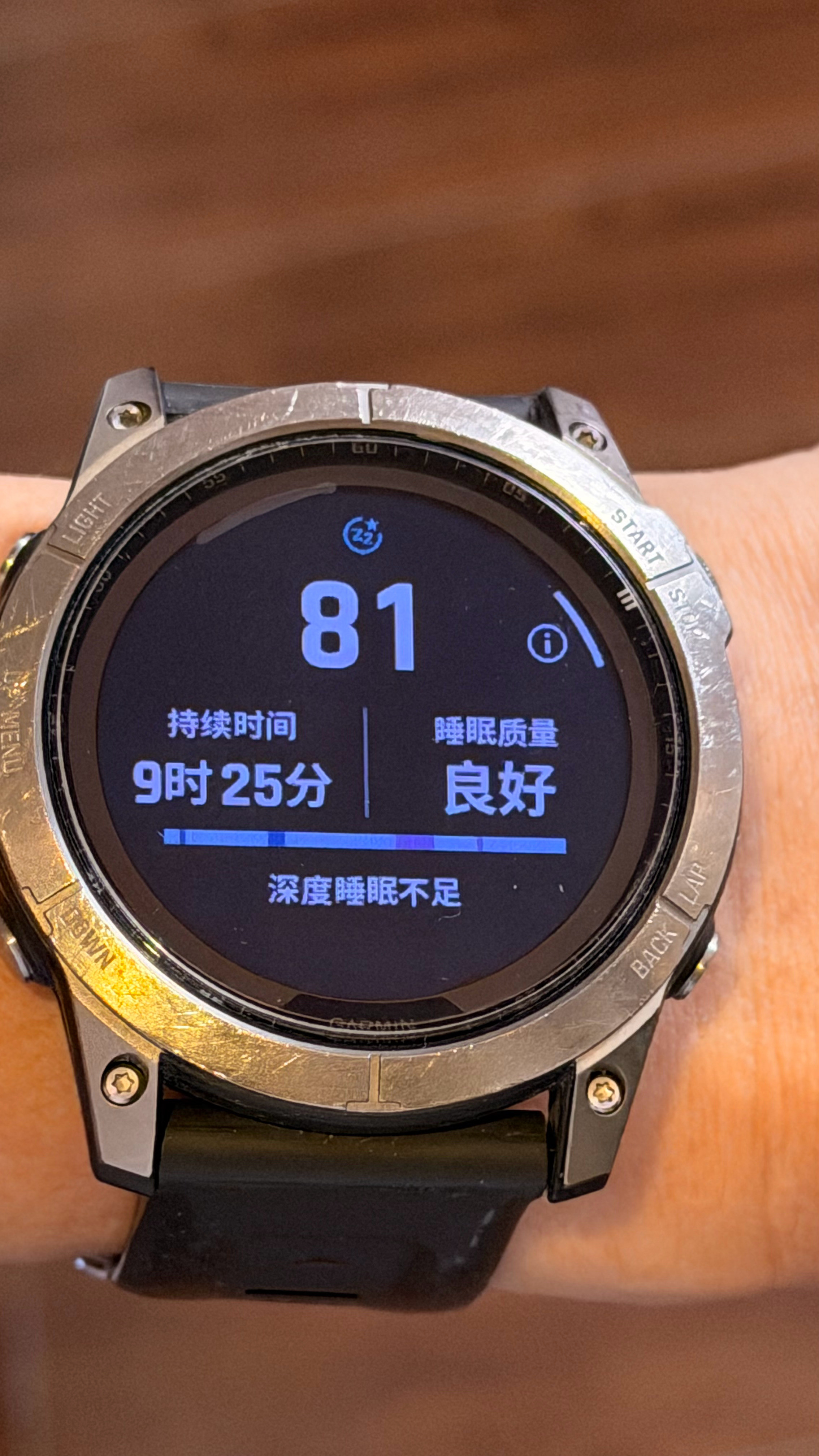 我不觉得带一块几百万的手表有多牛！我也不觉得带一块几千块的手表有多丢人！反正都是