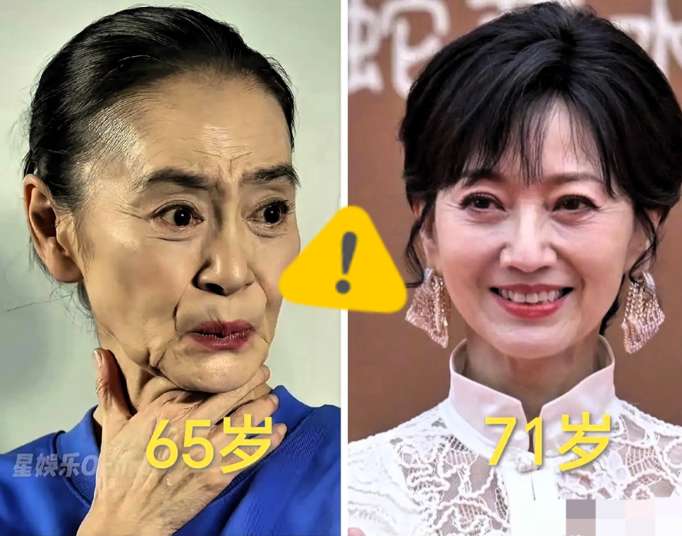 65岁的刘雪华给广大女性朋友上了一课！做为女人，你可以不医美，也可以不漂亮，
