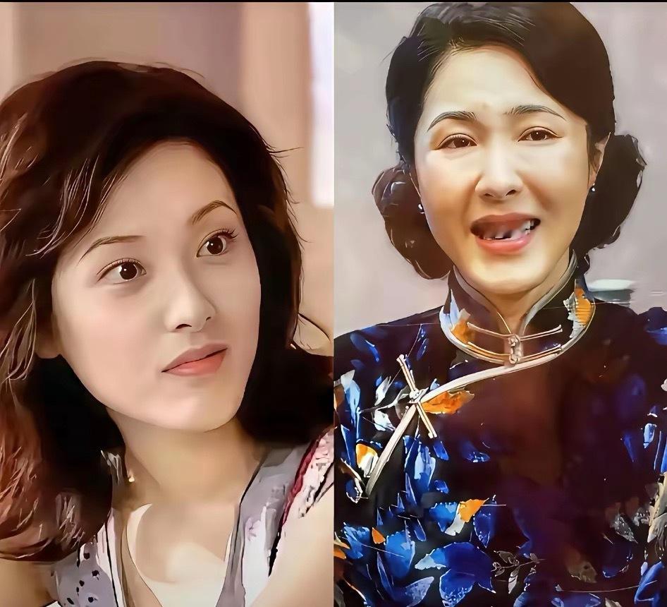 可怕的医美，毁了一个又一个，当医美让人变得笑起来比哭还难看，脸肿得像发面馒头，还