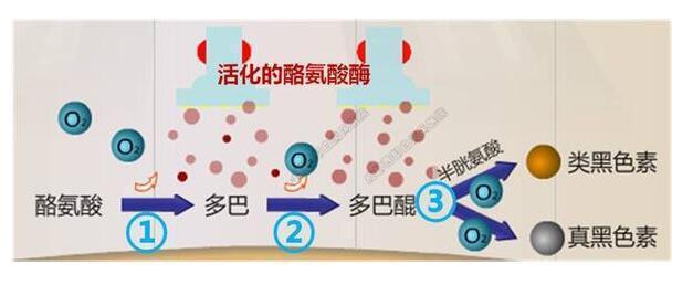 自身免疫因素对白癜风有没有影响?