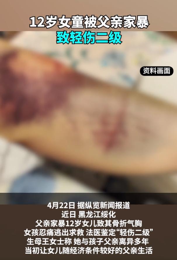 黑龙江绥化，女孩因与继母生下的弟弟互相呲水，被亲生父亲暴打，导致女孩骨折气胸。挨