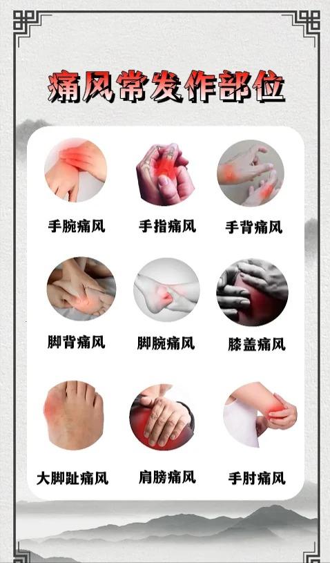 痛风常发作部位，你中招了吗？