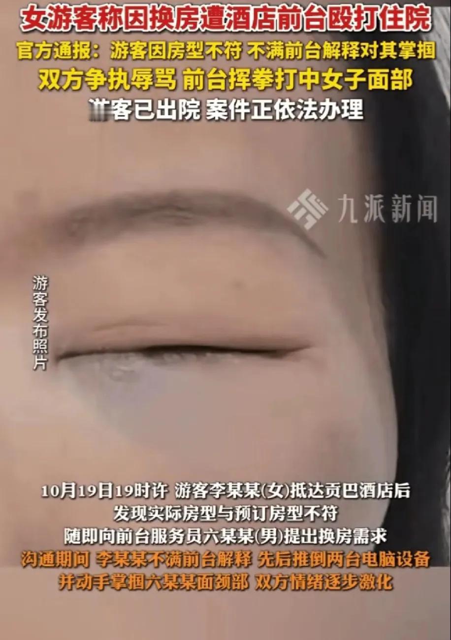 九寨沟住酒店起争执，女子先扇男服务员耳光，结果被一拳打肿脸，这亏吃的太没必要。