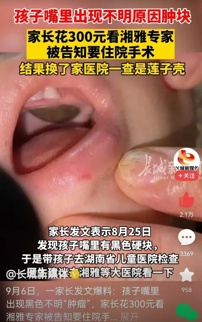 医疗市场化，天使变魔鬼。曾经北协和南湘雅，医术因精湛而出名。现在竟然……孩