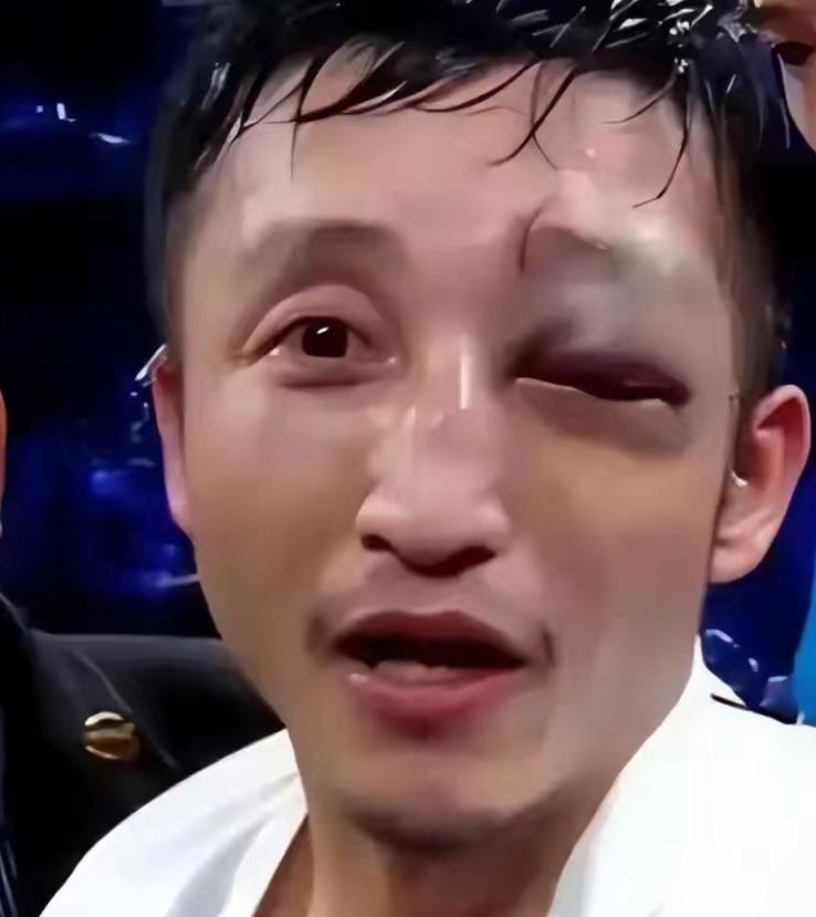 靠一拳一拳打来的2个亿，三年完美亏完了，还负债累累。退役时左眼视力只剩0.1，本