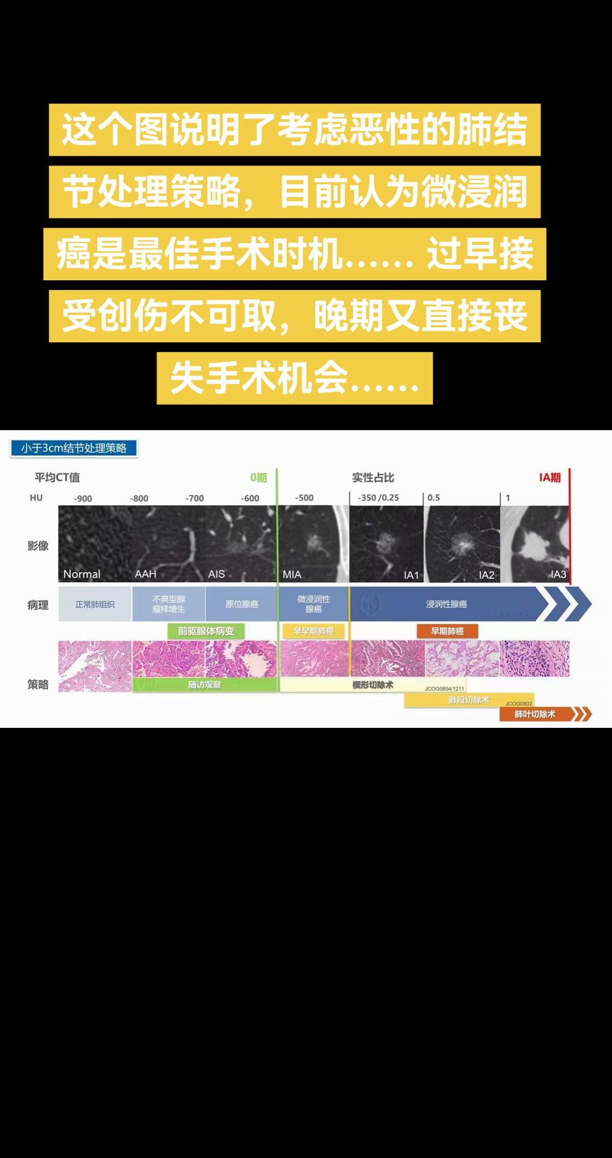 这个图说明了考虑恶性的肺结节处理策略，目前认为微浸润癌是最佳手术时机…...