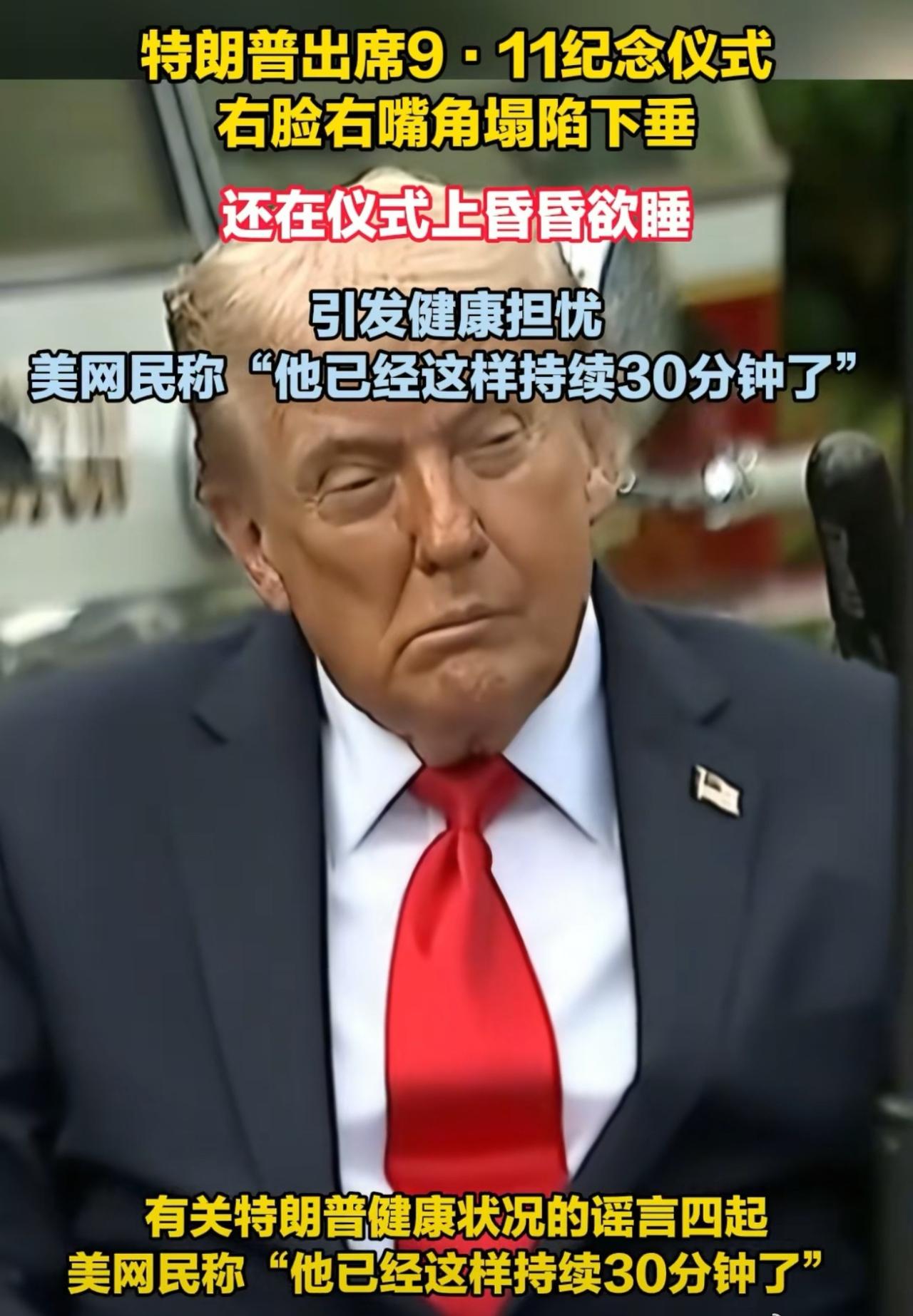 特朗普病情太严重了，原来脚肿，行动迟缓，手上长黑斑，这次又出现新情况！ 9月