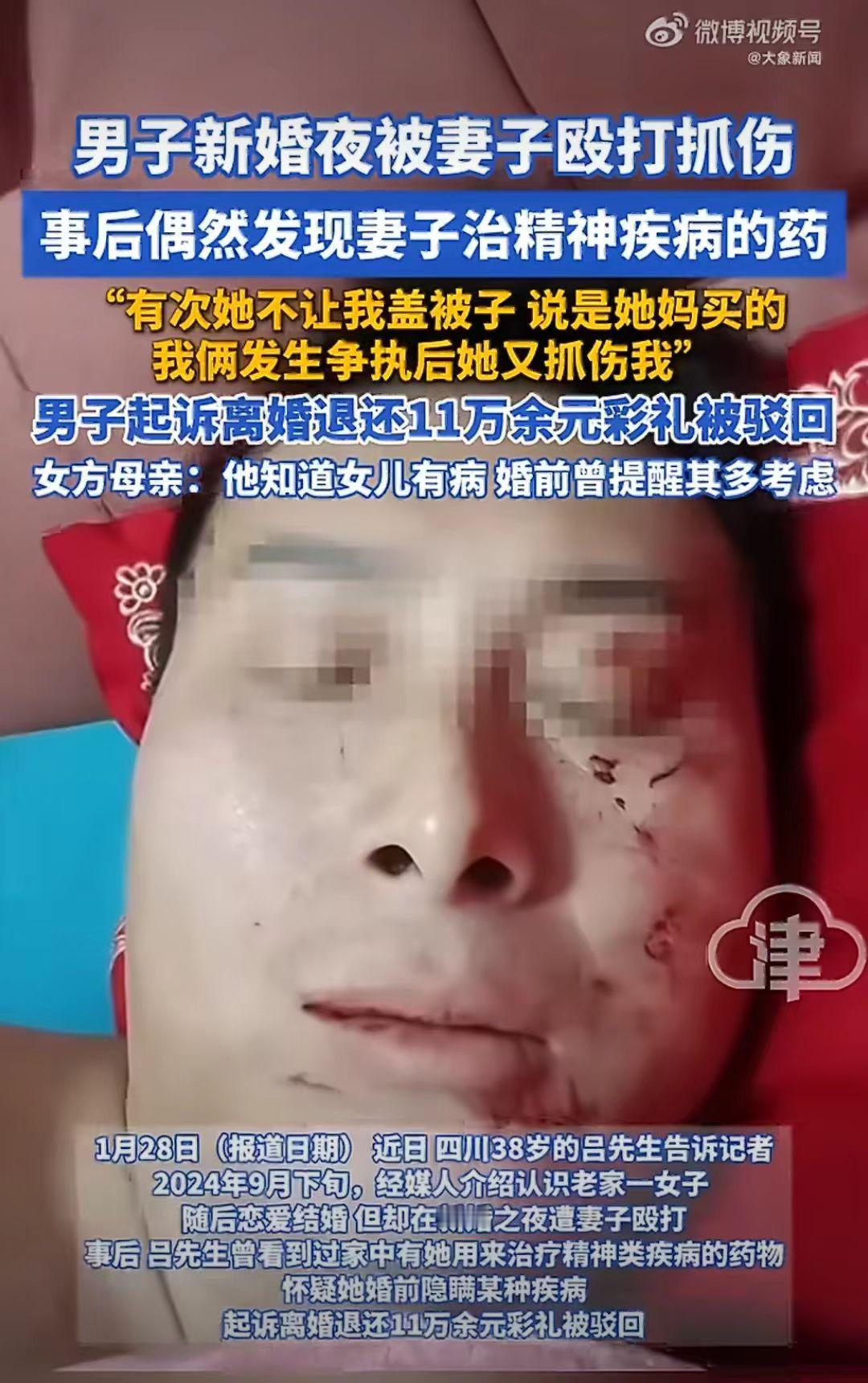 四川达州市，38岁的吕先生经媒人介绍认识小8岁的妻子李女士。新婚当晚，吕先生